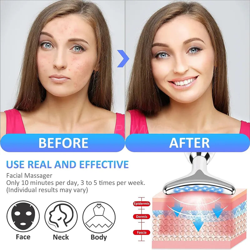 MyCarisma™ Appareil de Massage Visage